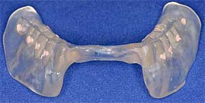 CT Scan Dental Implant Planning by Dr. David Richardson - Charleston South Carolina Implant Dentist